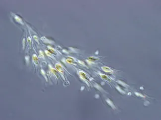 A microscopic view of Golden Algae